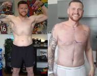 Before and after comparison of the surgery (Image via YouTube/Behzinga)